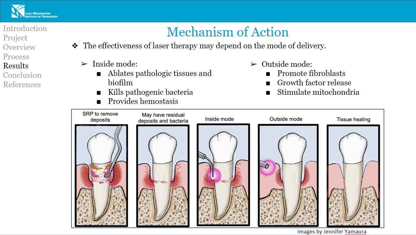 Images of teeth as slide of PPT for cover image