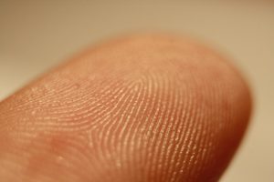 Photo of dermal ridges (fingerprint)