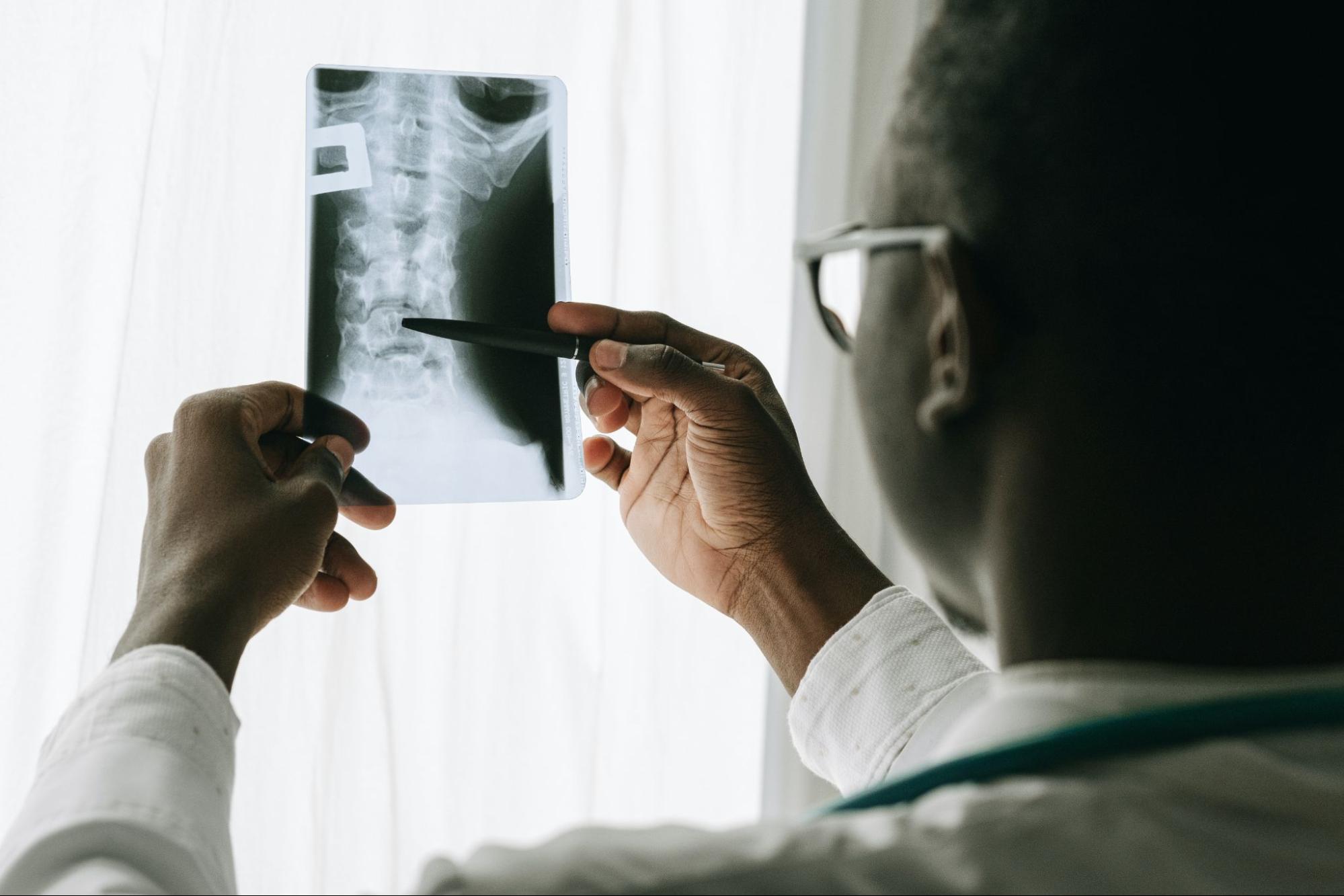 A healthcare professional looking at a physical copy of an x-ray.