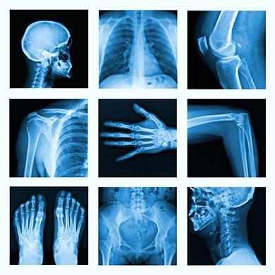 Medical X-Rays of various body parts and the bones within shown in a 3 by 3 array