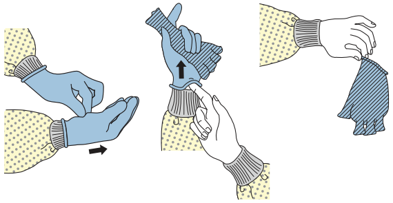 Sequence for removing gloves