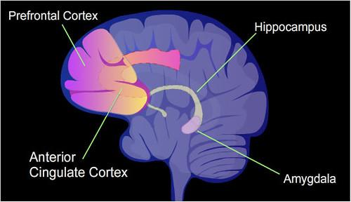 Picture of brain labeled with Prefrontal cortex, Hippocampus, Amygdala, and Anterior Cingulate Cortex.