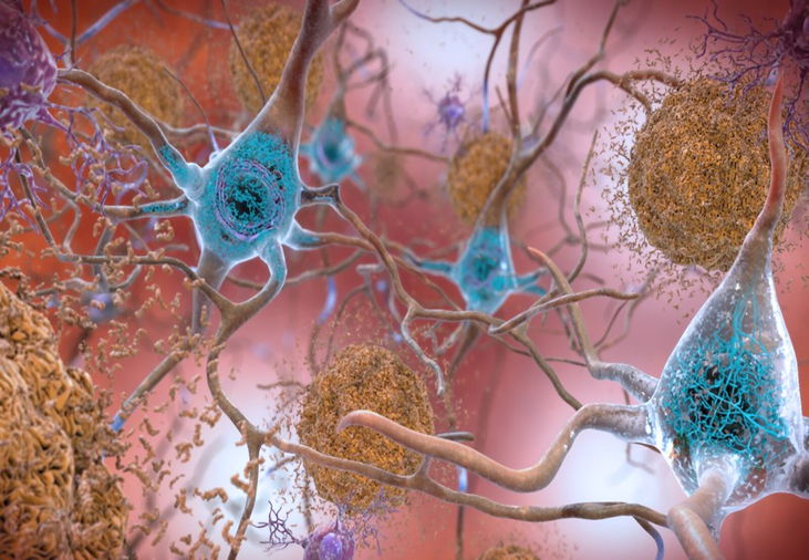 Picture of neuron connections in the brain.