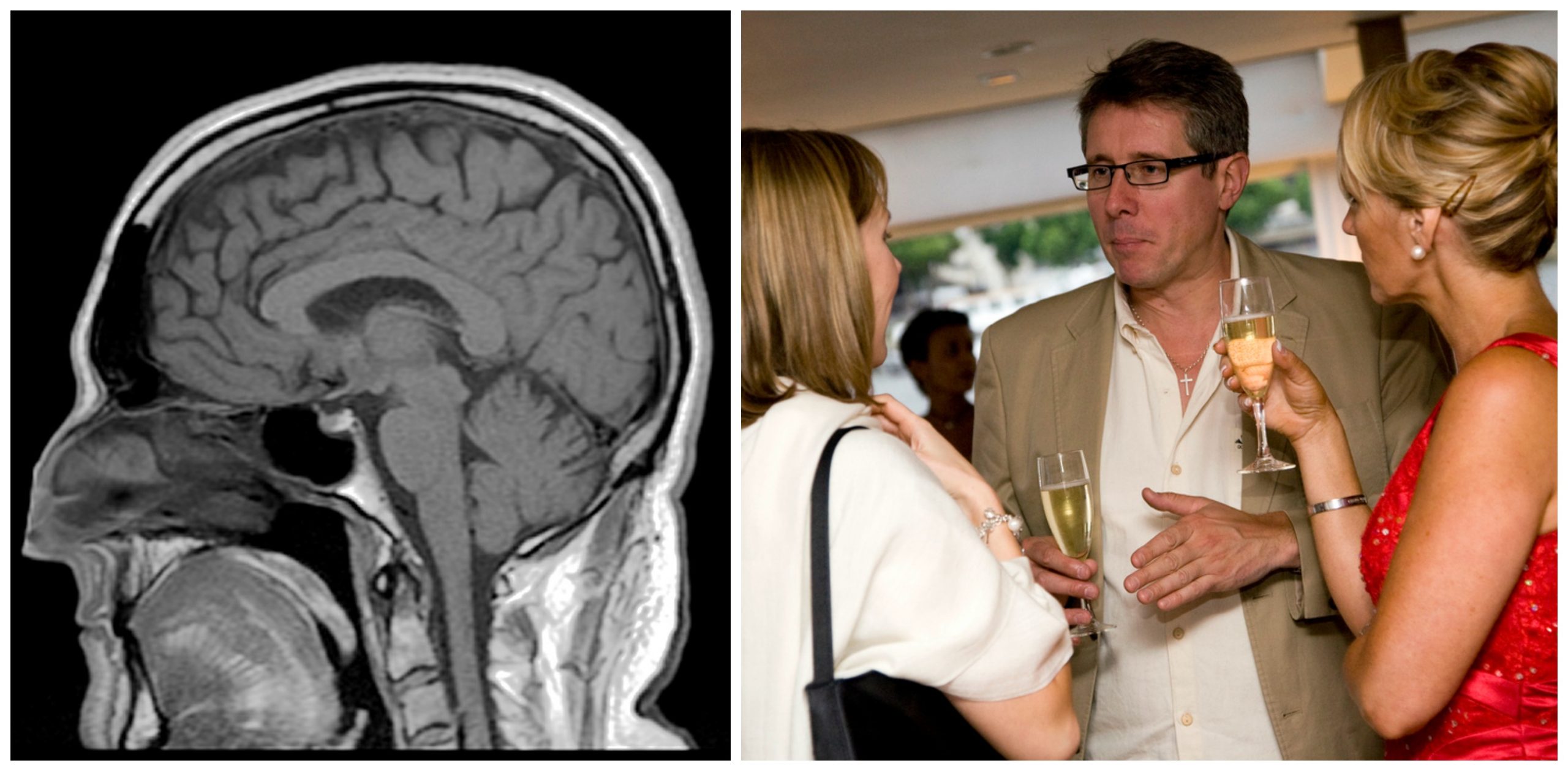 The cerebral cortex is the part of the brain that is involved in thinking. A big part of its job is social cognition--thinking about and understanding other people. (Picture of a brain x-ray, and a pictures of a group of people drinking champagne