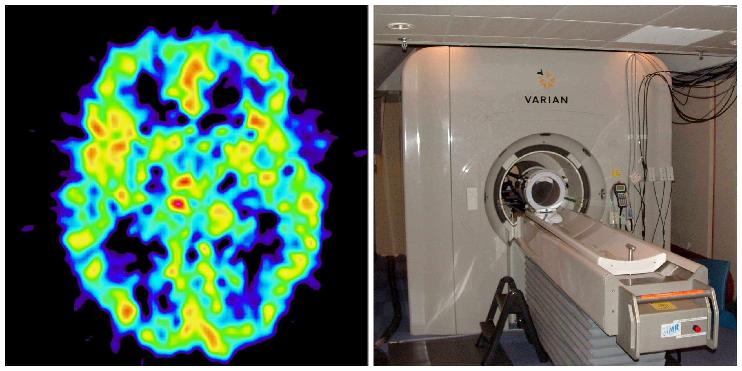 an fMRI image and an MRI machine
