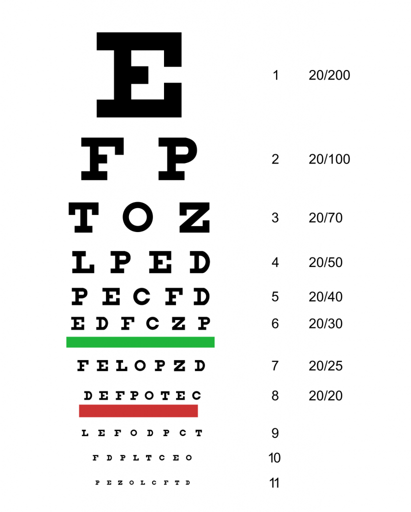 Image showing the Snellen Chart