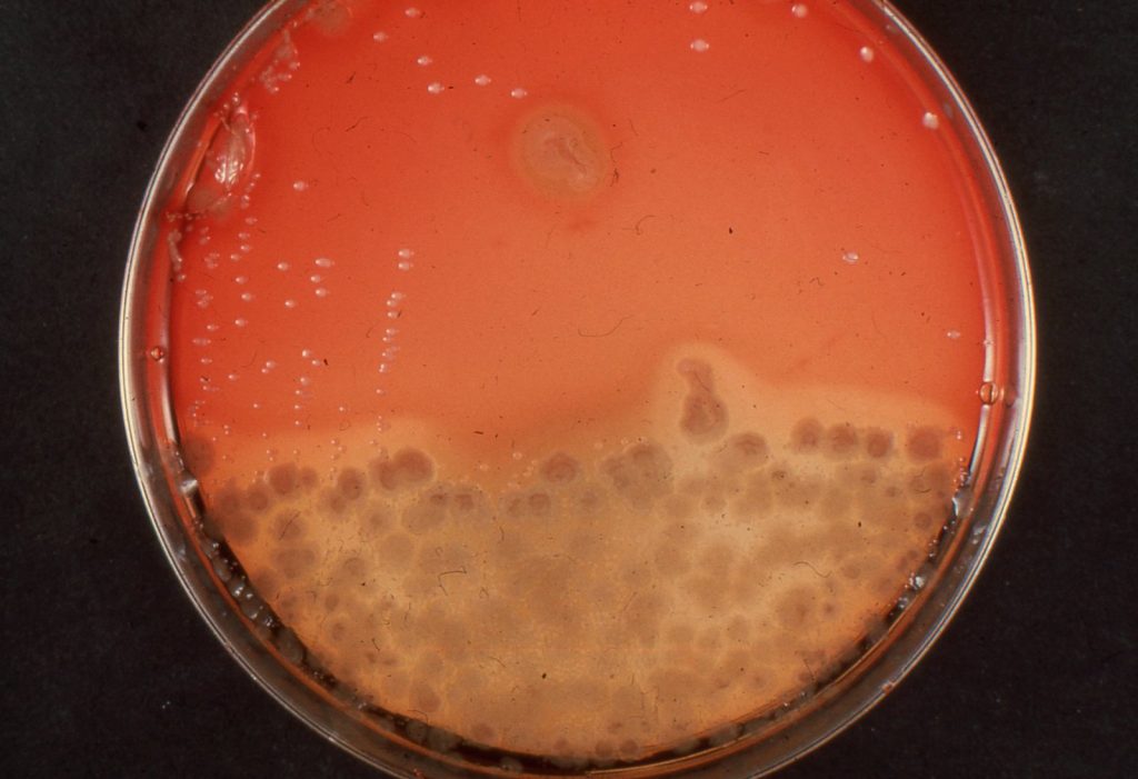 Photo showing a sputum culture