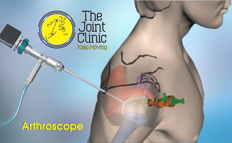 Image showing a simulated Shoulder Arthroscopy