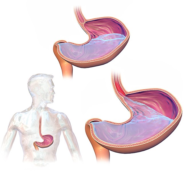 Illustration demonstrating location and physiology of GERD