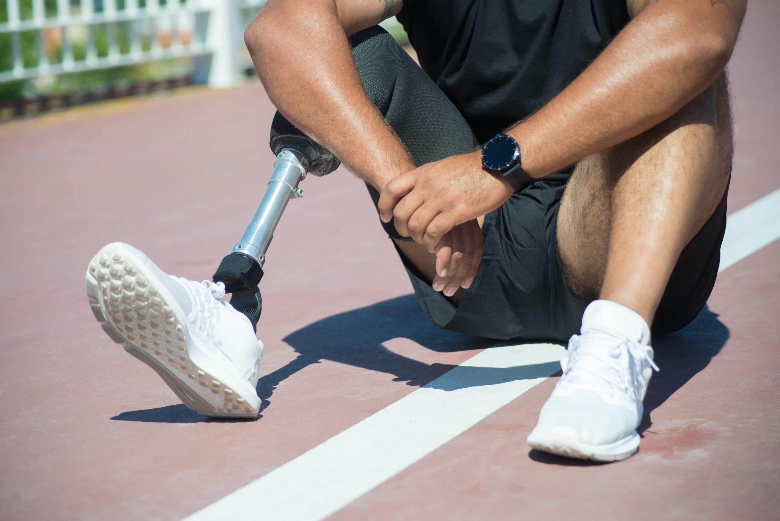 Image showing a person sitting, wearing a leg prosthesis