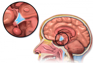 Diagram of the brain showing that the hypothalamus is a very small gland in the center of the brain at the top of the brain stem