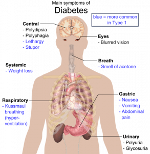 Symptoms of both Type 1 and Type 2 diabetes include polydipsia, polyphasia, polyuria, blurred vision, and glucose in the urine. Type 1 symptoms also include weight loss, lethargy, breath smelling of acetone, nausea, vomiting, and abdominal pain.