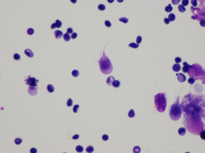 Photo of Giardia lamblia