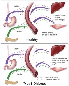 Healthy Individuals and Type 2 Diabetes