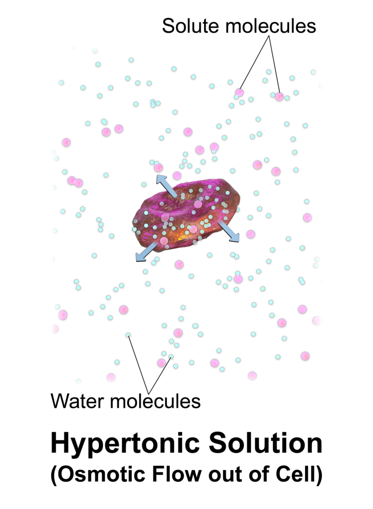 Image showing Hypertonic IV Solution Causing Osmotic Fluid Movement Out of a Cell